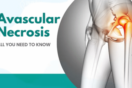 Homeopathic Medicine for Avascular Necrosis